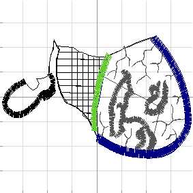 Abstract 5 (6)
